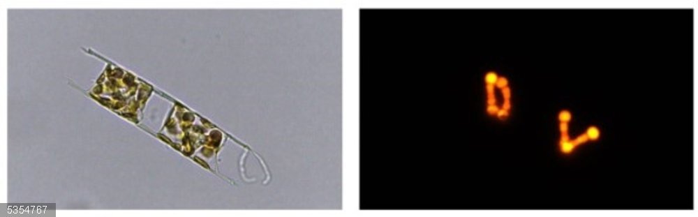 Asociación de la diatomea 'Hemiaulus hauckii' y la cianobacteria 'Richelia intracellularis' del Mediterráneo oriental. La micrografía de la izquierda muestra a la diatomea, mientras que la de la derecha identifica a la cianobacteria en su interior Asociación de la diatomea 'Hemiaulus hauckii' y la cianobacteria 'Richelia intracellularis' del Mediterráneo oriental. La micrografía de la izquierda muestra a la diatomea, mientras que la de la derecha identifica a la cianobacteria en su interior