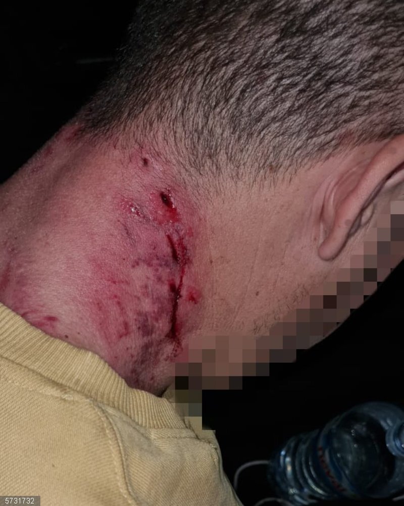 Jaén.- Sucesos.- Herido un hombre en la capital por mordeduras de un perro potencialmente peligroso Una mordedura del perro en el cuello del hombre.